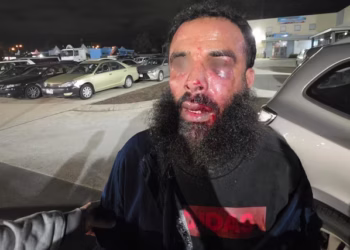 Bearded man with facial injuries and blood on his nose and eye area standing in a nighttime parking lot with cars.