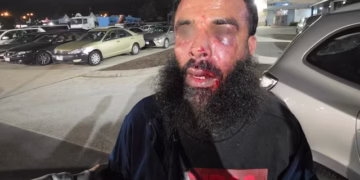Bearded man with facial injuries and blood on his nose and eye area standing in a nighttime parking lot with cars.